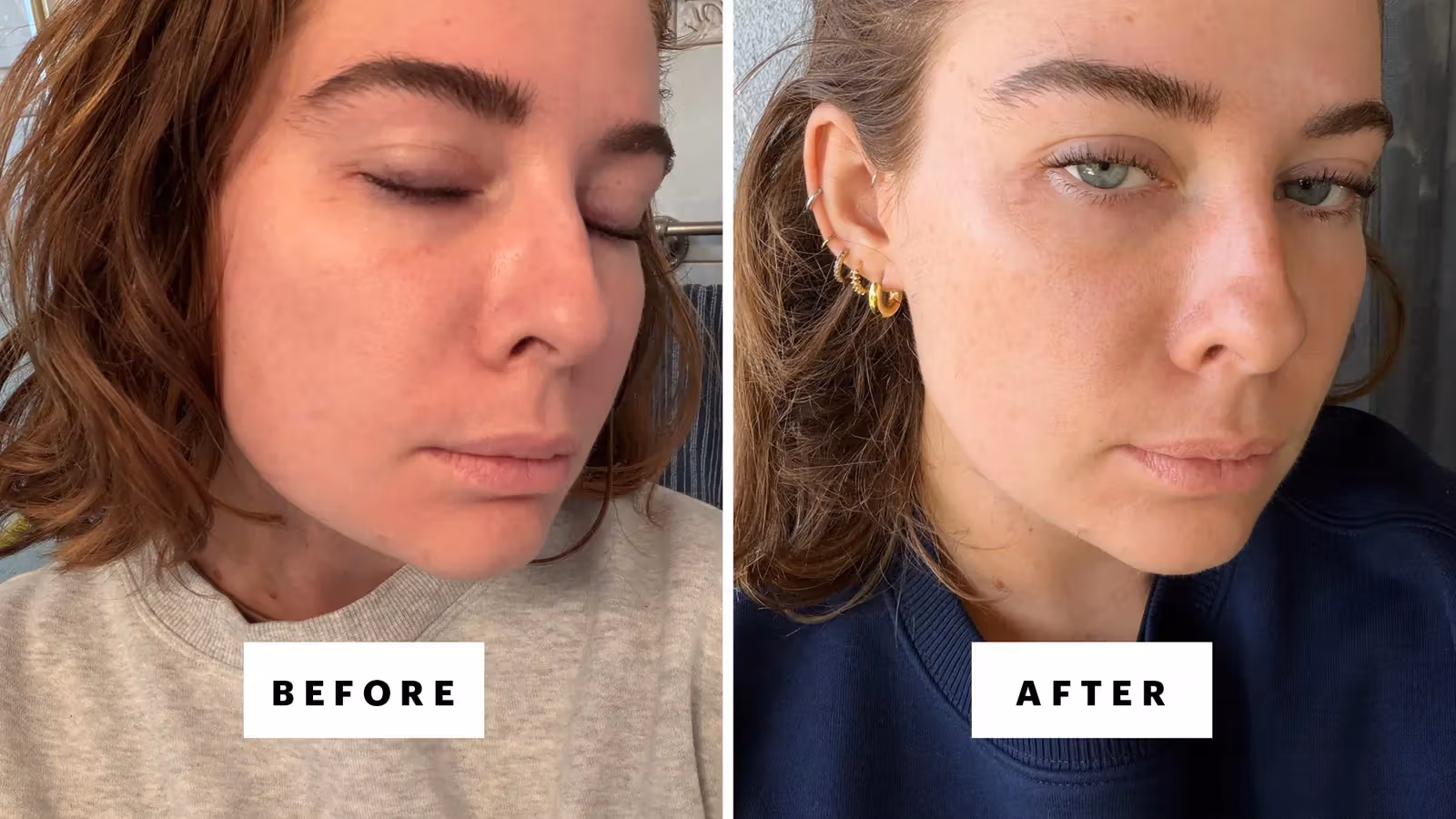 Mixing These Two TikTok-Favorite Ingredients May Just Give You Glass Skin